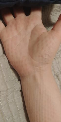 BestBide - Kézmasszírozó és regeneráló photo review